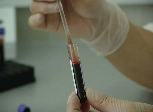 Immunotherapy takes cancer treatment into a new era