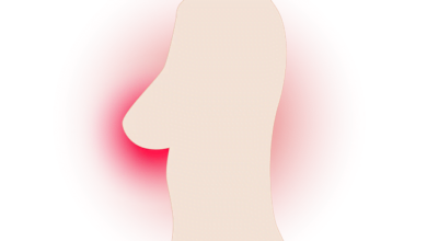 Breast Density Important Predictor Of Breast Cancer Risk