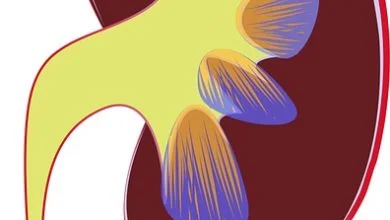 New colorectal cancer screening guidelines: Get screened earlier, expand testing options