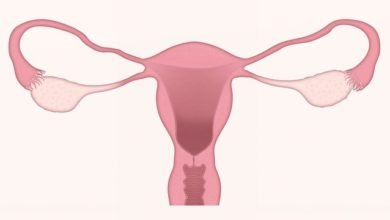 The Difference: Endometrial cancer and uterine sarcoma